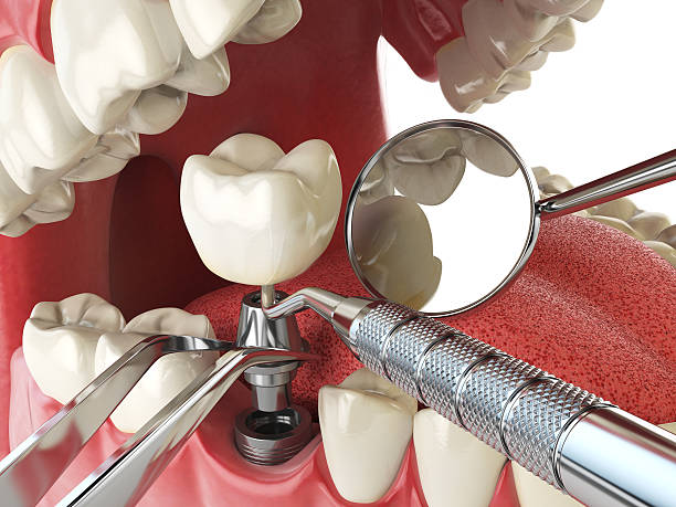Best Knocked-Out Tooth Emergency  in Roanoke, VA